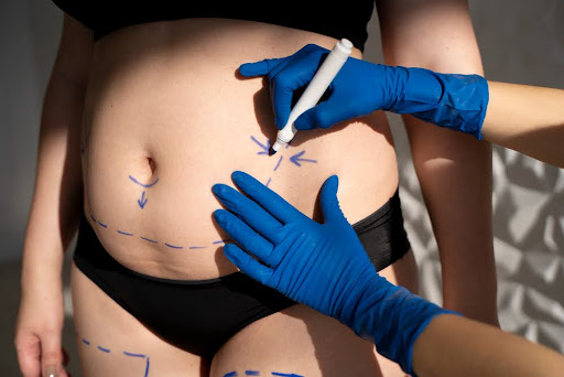 Alojamiento postoperatorio en Medellín